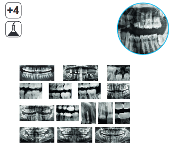 Rayos X Dental    R59269